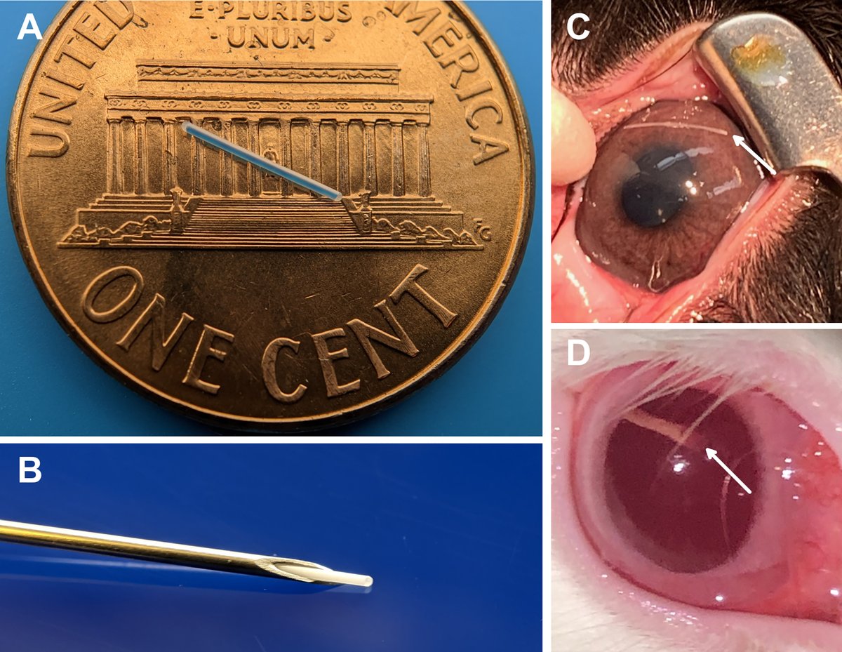 AAOjournal's tweet photo. In vivo comparison of intracameral and intravitreal implantation of a timolol maleate miniaturized injectable delivery system (MIDS) device
https://t.co/3PnCVtRMOt
#ophthalmology https://t.co/cefx67qGH2