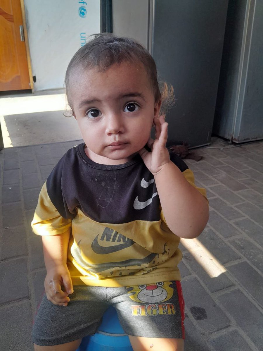 My daughter, as you can see, my daughter Suwar is starting to show signs that she is going to have a seizure. These are the symptoms. Please save Suwar. Please don’t… chuffed.org/project/138351…