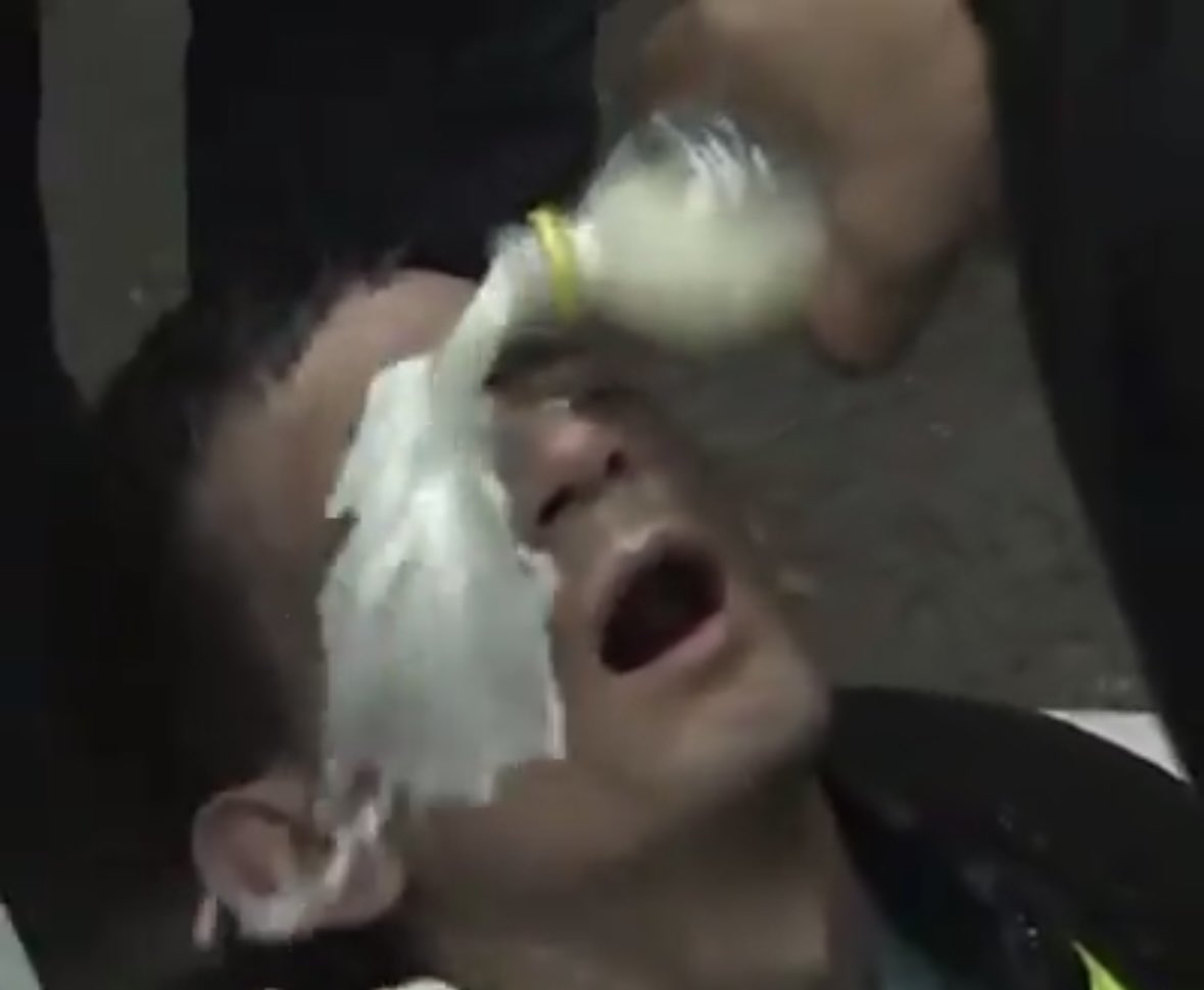 Lautaro🍊 tweet media