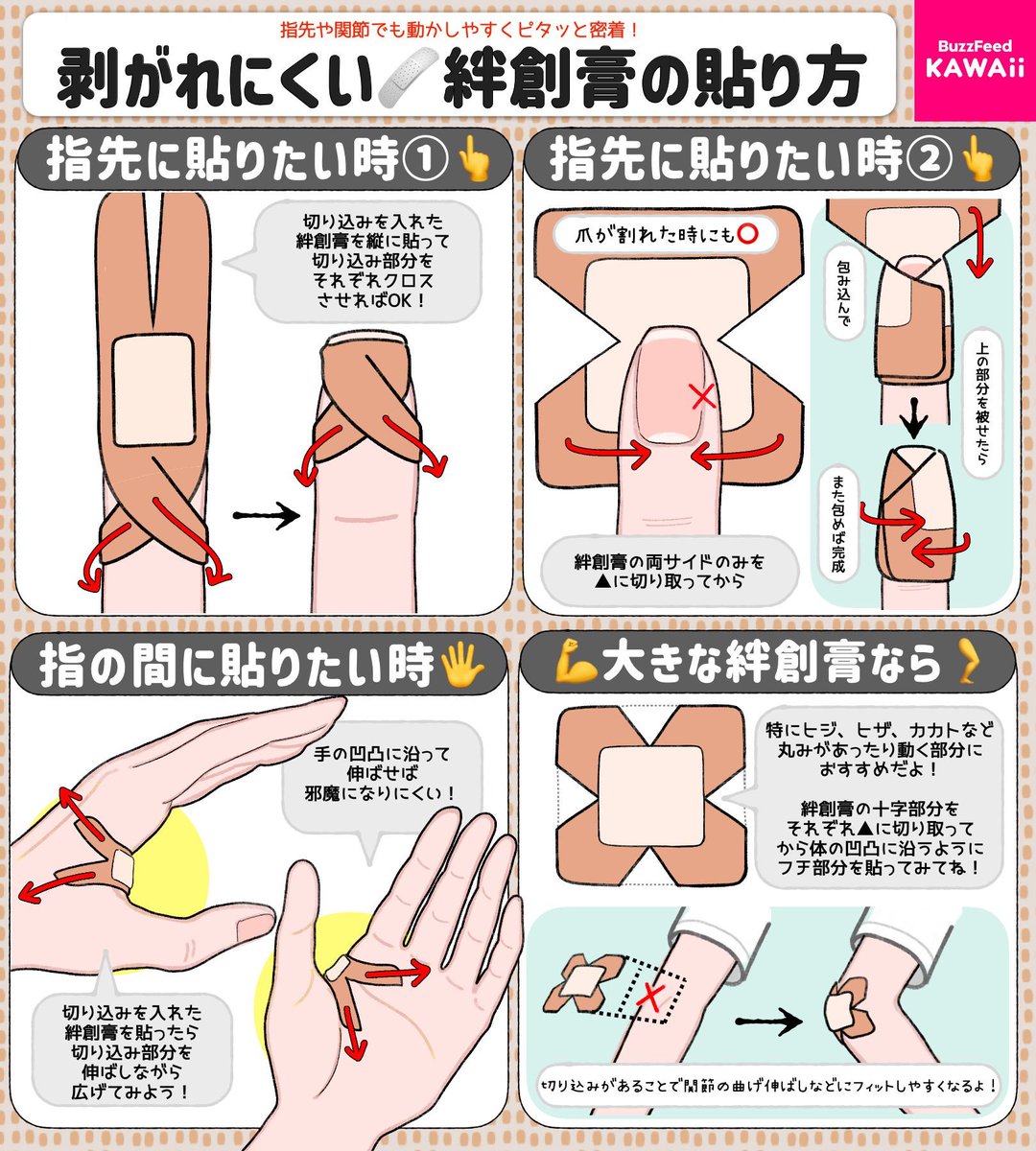 BuzzFeedKawaii's tweet photo. 「関節の傷・爪が割れた時」にも役立つ🚑 🚨 

剥がれにくい絆創膏の貼り方をまとめたよ🩹✨ https://t.co/v7HnZb1dKk