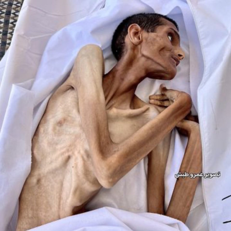 BenselemK's tweet photo. صورة تعبر عن تعفن الانظمة العبرية والمتاءسلمة اللتي تشارك في تجويع اهل غزة العزة التي رفعت راية الكرامة نيابة عن هذه  الأمة  الخبيثة والنجسة،،، https://t.co/mbBzMrMsYU