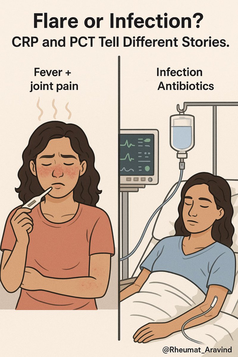 Aravind Palraj (@rheumat_aravind) on Twitter photo 🧵 CRP vs Procalcitonin in Fever Workup 🔍
Flare? Infection? Both? Let’s break it down clinically — one step at a time.👇
#MedTwitter #Rheumatology #Infection <a href="/IhabFathiSulima/">Dr Ihab Suliman</a> <a href="/DrAkhilX/">Dr. Akhil 🇮🇳</a> <a href="/CelestinoGutirr/">Dr Celestino Gutiérrez González MD 🇪🇸🍏🇻🇪</a> 🧵 CRP vs Procalcitonin in Fever Workup 🔍
Flare? Infection? Both? Let’s break it down clinically — one step at a time.👇
#MedTwitter #Rheumatology #Infection <a href="/IhabFathiSulima/">Dr Ihab Suliman</a> <a href="/DrAkhilX/">Dr. Akhil 🇮🇳</a> <a href="/CelestinoGutirr/">Dr Celestino Gutiérrez González MD 🇪🇸🍏🇻🇪</a>
