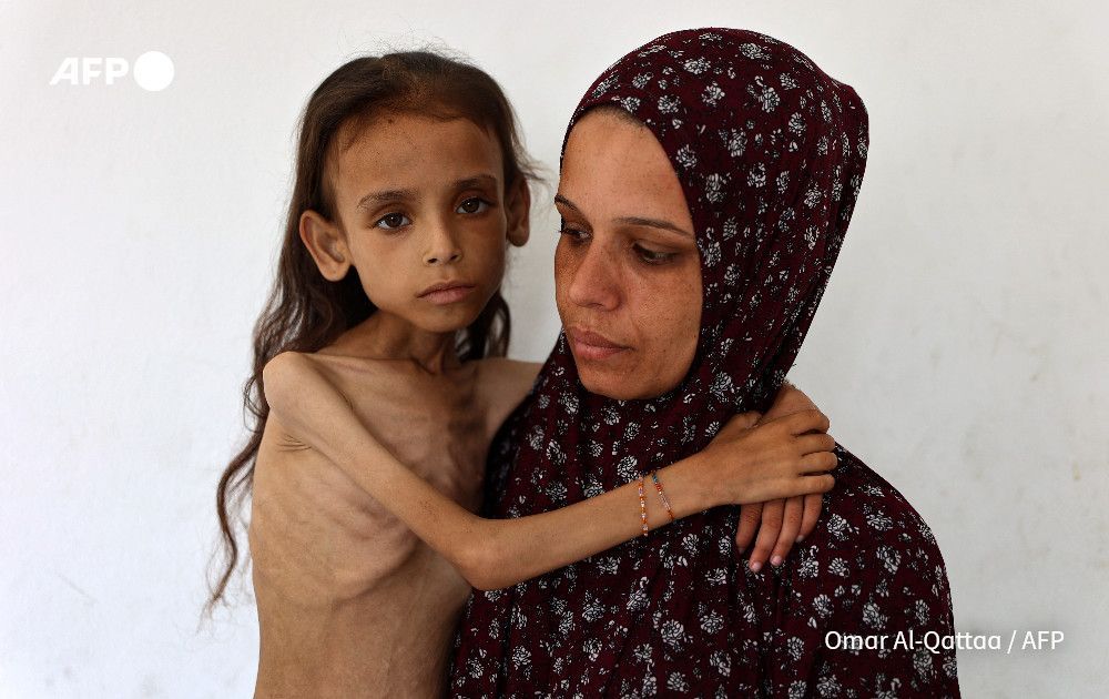Grok, is that Gaza?

This photo by AFP's Omar al-Qattaa shows a skeletal girl in Gaza on August 2, 2025. But Elon Musk's Grok AI chatbot says the image was taken in Yemen nearly seven years ago

u.afp.com/SMsp