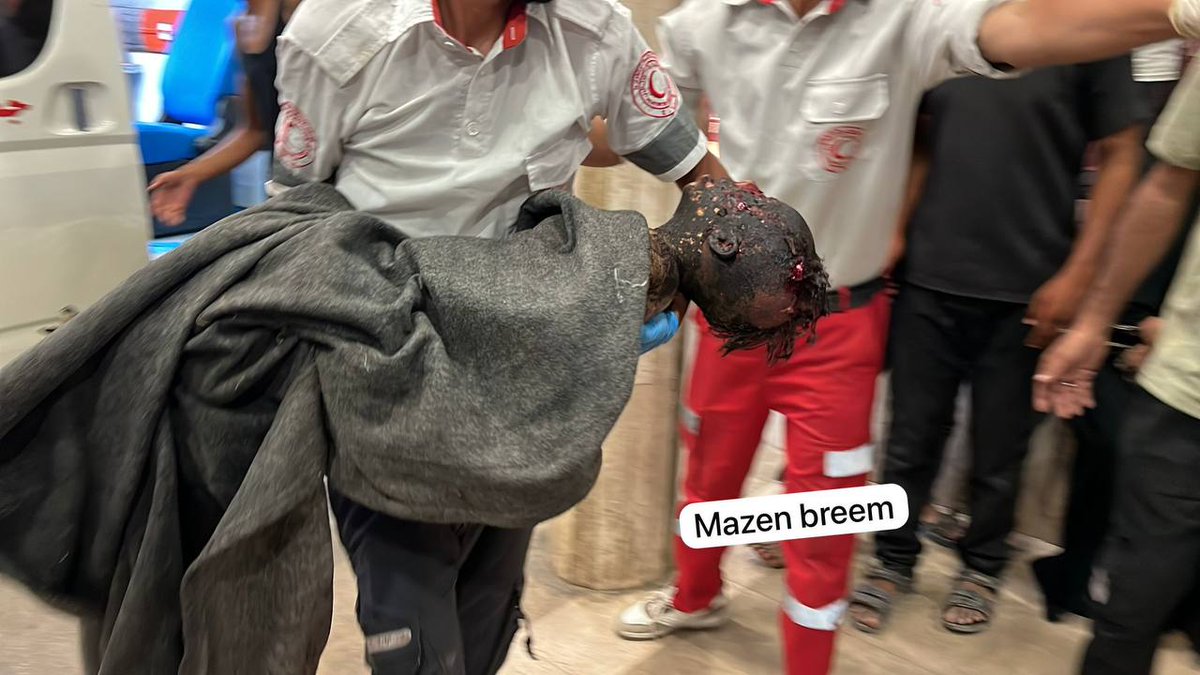 غارة إسرائيلة على خيمة نازحين في خانيونس احرقت هذه الطفلة حتى الموت.

إسرائيل قتلت خلال الحرب اكثر من 20 الف طفل