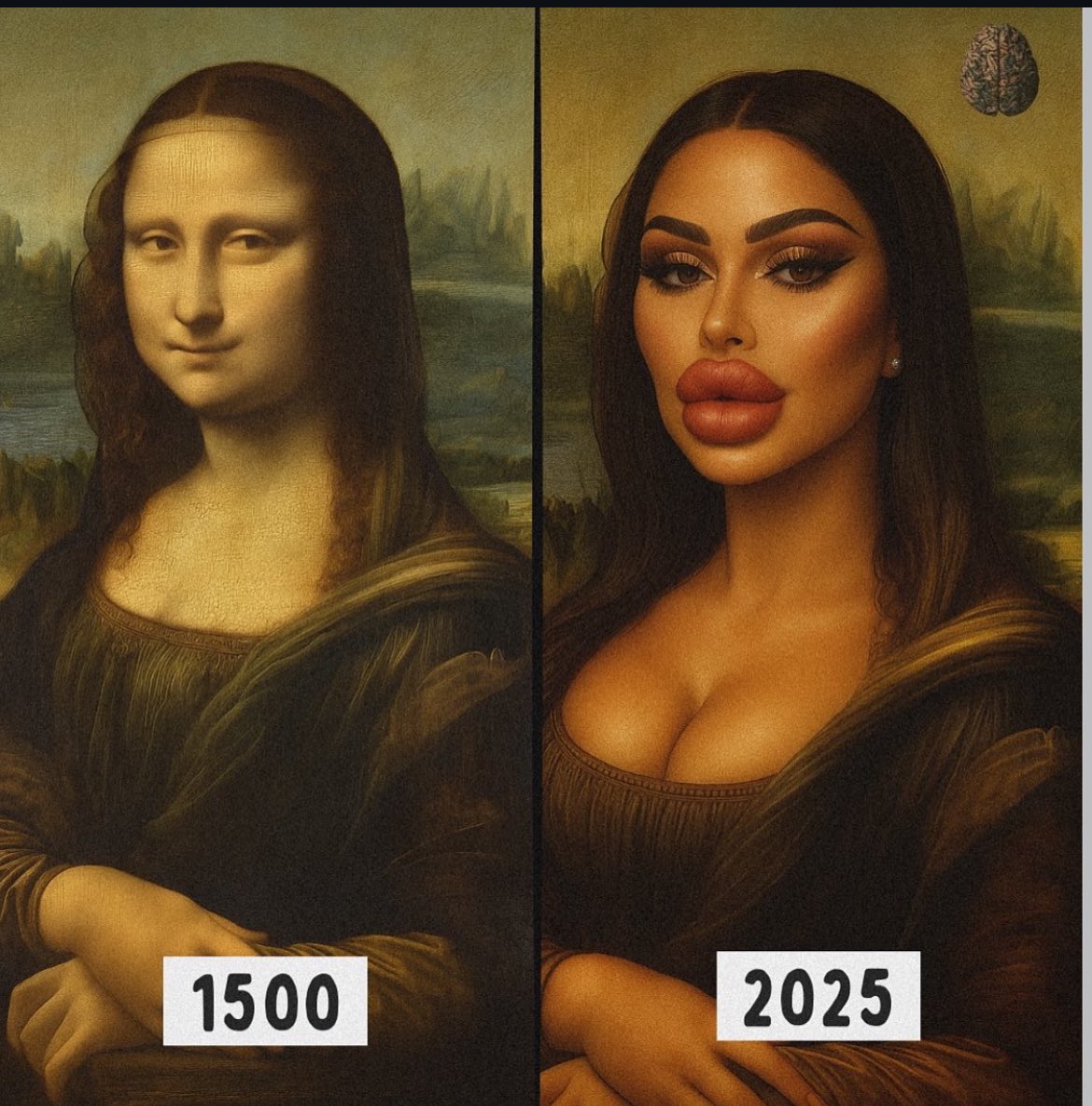 canalangel's tweet image. #CosmeticSurgery 

Agree it does need regulating or even outlawing.  It’s not a good look now is it?

#GMB