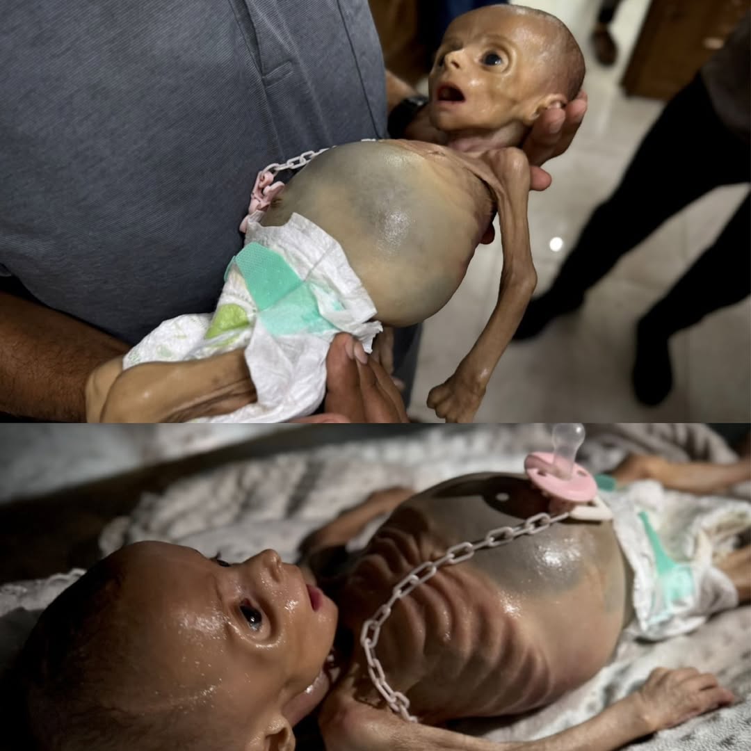 Gazze'de çocuklar açlıktan ölüyor 💔