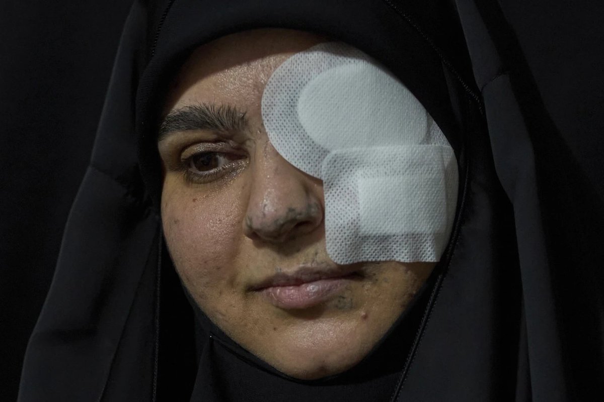 Sibi Arasu (@sibi123) on Twitter photo Powerful, sad report by <a href="/AP/">The Associated Press</a> colleagues in Lebanon, Bassam Mroue, <a href="/seldeeb/">Sarah El Deeb</a> and <a href="/HassanAmmar5/">Hassan Ammar</a> about the horrifying aftermath of Israel's pager attacks. apnews.com/projects/israe… Powerful, sad report by <a href="/AP/">The Associated Press</a> colleagues in Lebanon, Bassam Mroue, <a href="/seldeeb/">Sarah El Deeb</a> and <a href="/HassanAmmar5/">Hassan Ammar</a> about the horrifying aftermath of Israel's pager attacks. apnews.com/projects/israe…