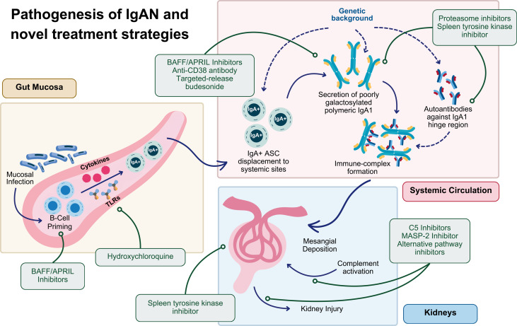 IgA Nephropathy #IgAN: An Overview of the Clinical Trials ca. 2025 from <a href="/KidneyMed/">Kidney Medicine</a> <a href="/ZohrehGh7/">Zohreh.Gh</a> <a href="/haresh11/">Haresh Selvaskandan</a> <a href="/NWiegley/">Nasim Wiegley, MD, FASN</a> <a href="/Alexgr23/">Alejandro Garcia-Rivera</a> <a href="/rahaai/">Amir Abdipour, MD, FASN</a> <a href="/SaynaNorouzi/">Sayna Norouzi, MD, FASN</a> <a href="/JEGAYTAN90/">Jorge Gaytan Arocha</a> 
#Nephpearls 

👉 kidneymedicinejournal.org/article/S2590-…