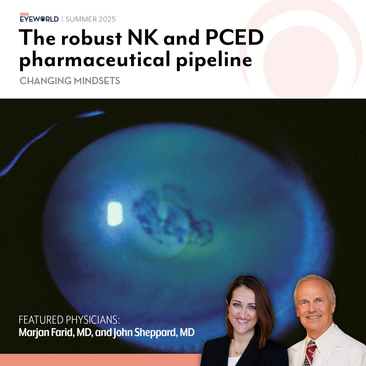 The pharmaceutical treatment options for PCED and NK might be growing. At least half a dozen investigational drugs are in the pipeline. Marjan Farid, MD, and John Sheppard, MD, provide their insights on some of these options bit.ly/45hDZ7G  #EyeWorldMagazine
