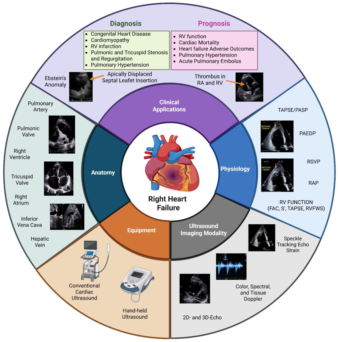 A Narrative Review of the Clinical Applications of Echocardiography in Right Heart Failure 

CCR Journal Watch - tracking the critical care literature daily
criticalcarereviews.com/latest-evidenc…