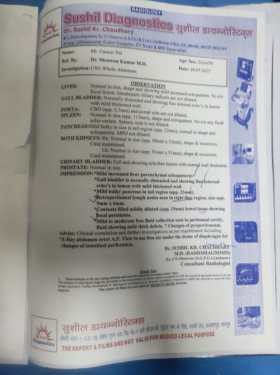 प्रवीण कुमार (@itspravin99) on Twitter photo गौरव पाल उम्र 18 साल निवासी कानपुर नगर. दो दिन पहले उनकी आंत का ऑपरेशन हुआ है. फेफड़ों में पानी भर गया जिसके चलते साँस लेने में दिक्कत हो रही है. 4 दिन से निजी अस्पताल में वेंटिलेटर पर है. जो बन सके थोड़ी थोड़ी हेल्प कर दीजिए---
✍️
<a href="/RajeevRai/">Rajeev Rai</a> <a href="/AnilYadavmedia1/">ANIL</a> <a href="/AnilPalAdv/">𝘼𝙙𝙫 𝘼𝙉𝙄𝙇 𝙋𝘼𝙇</a> गौरव पाल उम्र 18 साल निवासी कानपुर नगर. दो दिन पहले उनकी आंत का ऑपरेशन हुआ है. फेफड़ों में पानी भर गया जिसके चलते साँस लेने में दिक्कत हो रही है. 4 दिन से निजी अस्पताल में वेंटिलेटर पर है. जो बन सके थोड़ी थोड़ी हेल्प कर दीजिए---
✍️
<a href="/RajeevRai/">Rajeev Rai</a> <a href="/AnilYadavmedia1/">ANIL</a> <a href="/AnilPalAdv/">𝘼𝙙𝙫 𝘼𝙉𝙄𝙇 𝙋𝘼𝙇</a>