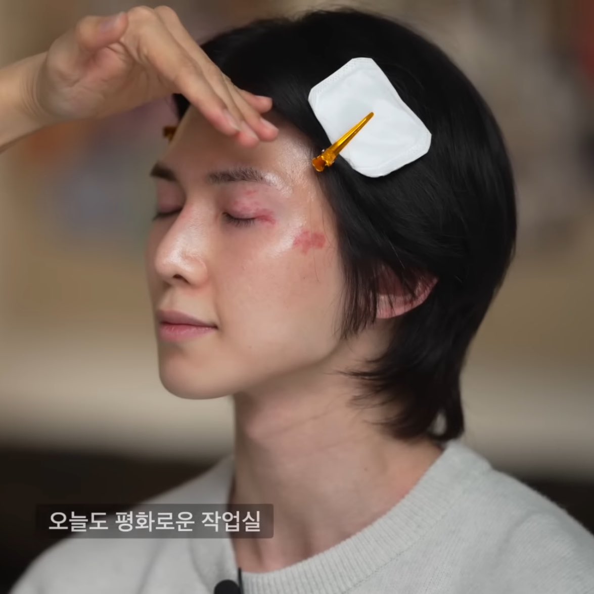 Heartp0psup's tweet photo. 눈 옆이랑 광대 쪽 모반은 상대적으로 자주 봤지만 눈꺼풀 위에 있는 건 초면이야... 진짜 찐 쌩얼로 모반 전부를 한꺼번에 보니까 신기하고 진짜 인외 같아...... https://t.co/wShr8efOIr