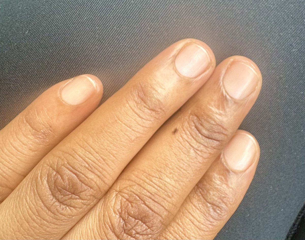 Someone just told me that my fingers + the nails look like for a man 😊😊

Ojone ci cinga cal ki cing lacoo? 😊😂