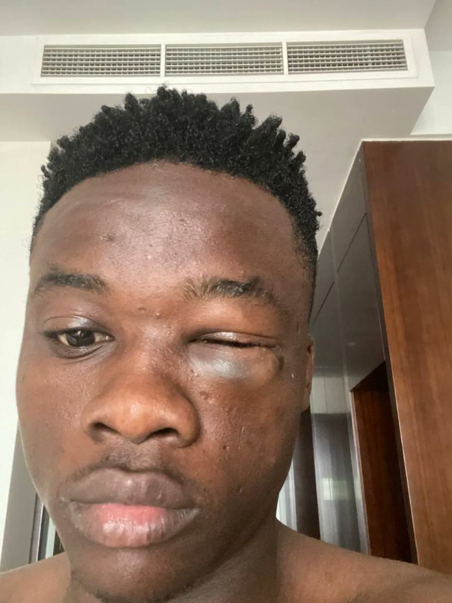 Muonekano wa kiungo Ahmed Pipino baada ya kushidwa kumaliza mchezo wake wa jana dhidi ya Mauritania ambapo aliingia Sub kuchukua nafasi nafasi ya Yusuph Kagoma mwanzoni mwa kipindi cha pili.