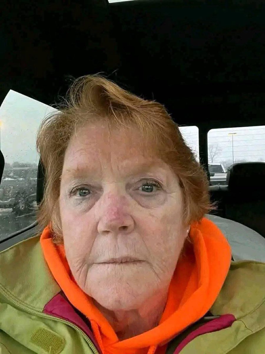 IVERMECTIN and MEBENDAZOLE Testimonial - 75 year old patient with Breast cancer 10 years ago, has 5 new breast masses. They almost completely disappear after 4 months on protocol!
Some of the results I get are absolutely jaw dropping.
This one is a "must see".
STORY:
75 year old