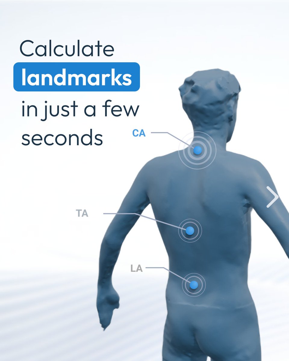 BeyondShape - 3D medical scanning tweet media