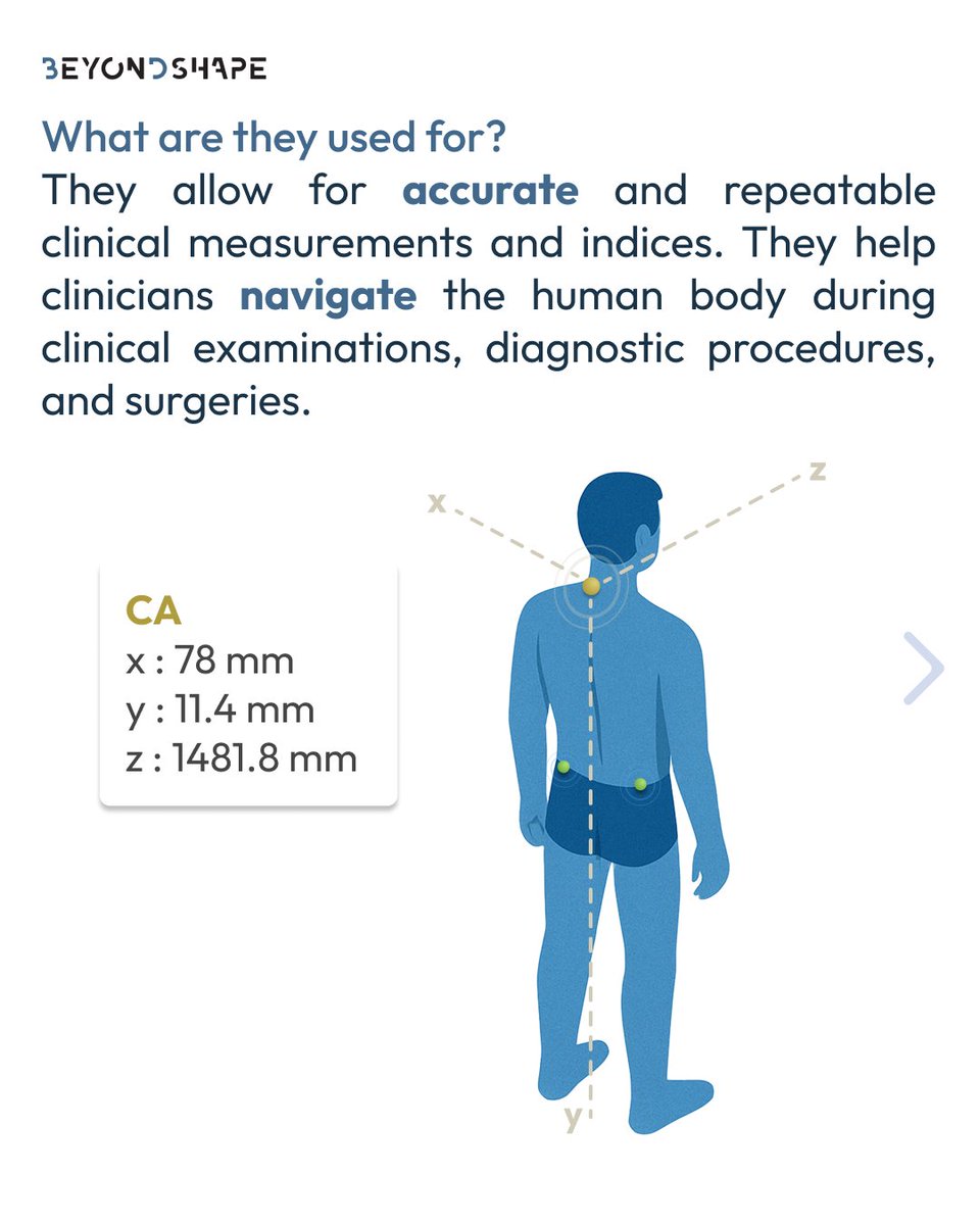 BeyondShape - 3D medical scanning tweet media