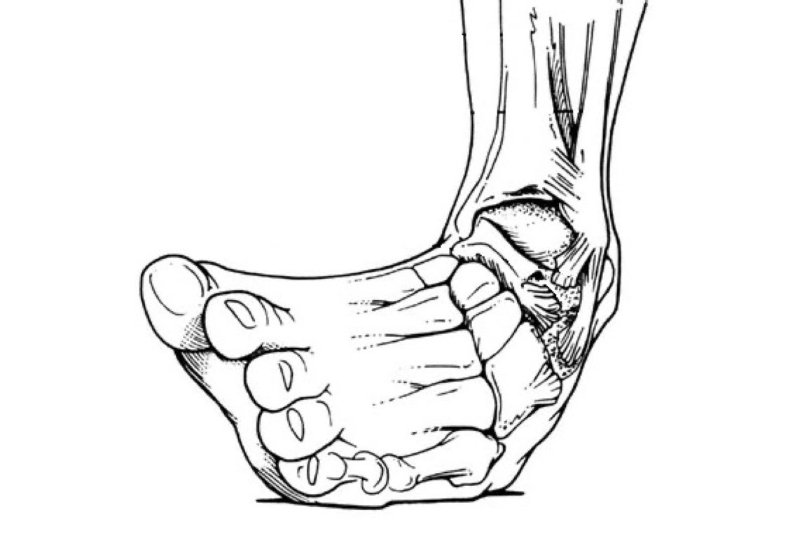 Hoops (@hoopmixonly) on Twitter photo If you played sports before you can feel the pain just by looking at this picture If you played sports before you can feel the pain just by looking at this picture