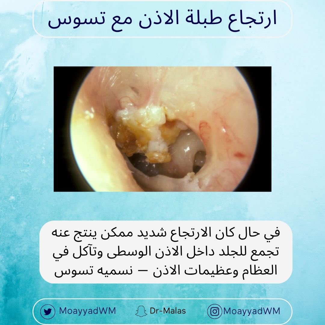 د. مؤيد ملص tweet media