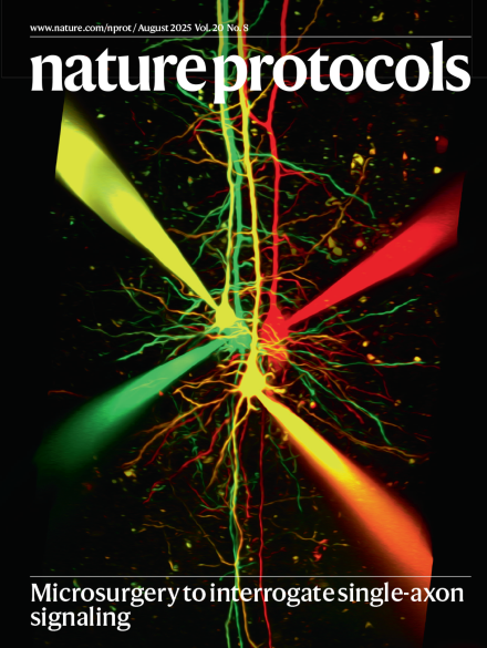 Hovy Wong @HovyWong.bsky.social (@hovy_wong) on Twitter photo These lovely neurons made it to the journal cover!
nature.com/nprot/volumes/…
With <a href="/alanna_j_watt/">Alanna Watt</a> and <a href="/pj_sjostrom/">Jesper Sjöström @pjsjostrom.bsky.social</a> in <a href="/NatureProtocols/">Nature Protocols</a>. These lovely neurons made it to the journal cover!
nature.com/nprot/volumes/…
With <a href="/alanna_j_watt/">Alanna Watt</a> and <a href="/pj_sjostrom/">Jesper Sjöström @pjsjostrom.bsky.social</a> in <a href="/NatureProtocols/">Nature Protocols</a>.