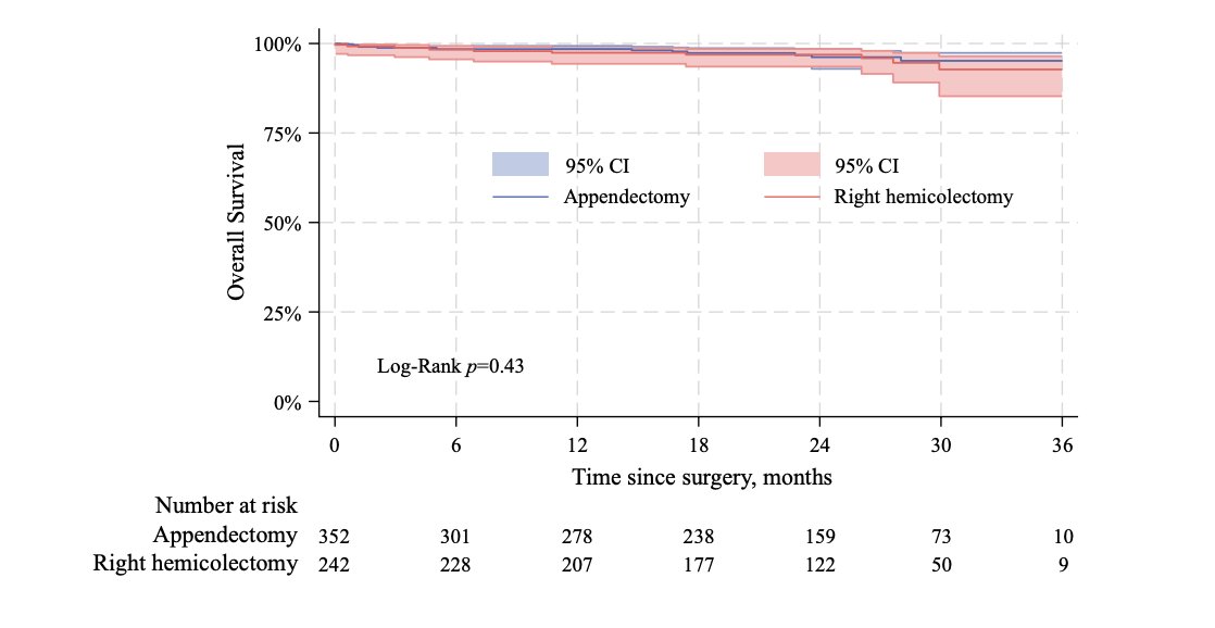 Julie Hallet (@halletjulie) on Twitter photo Mesoappendix invasion not a criteria for right hemi in appendix #NETs๐ฆ
๐ฅ4800 pts
๐ฌmeso invasion not associated with LN+ on its own
๐size main risk factor
No difference in OS appendectomy vs right hemi๐
Timely for new <a href="/NANETS1/">NANETS</a> guidelines!
๐๐link.springer.com/article/10.124โฆ Mesoappendix invasion not a criteria for right hemi in appendix #NETs๐ฆ
๐ฅ4800 pts
๐ฌmeso invasion not associated with LN+ on its own
๐size main risk factor
No difference in OS appendectomy vs right hemi๐
Timely for new <a href="/NANETS1/">NANETS</a> guidelines!
๐๐link.springer.com/article/10.124โฆ