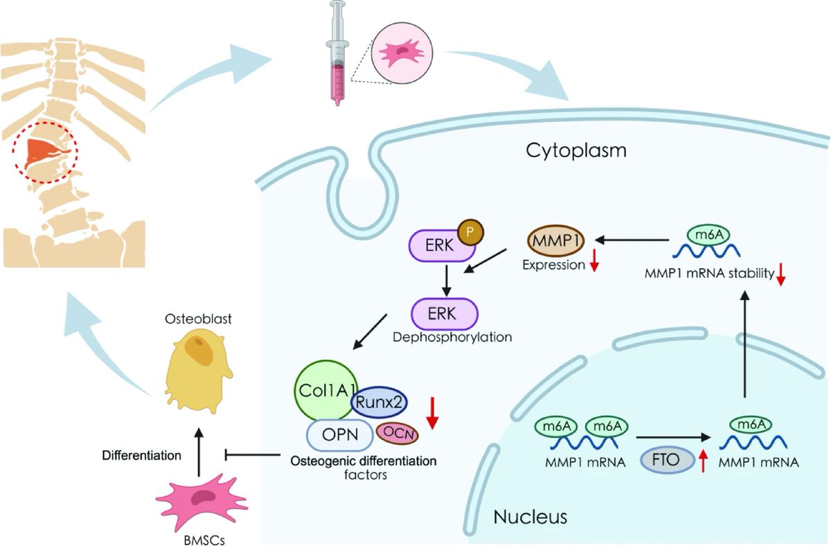 Mesenchymal Cell News (@mesenchymalcell) on Twitter photo Scientists including Dr. Hongqi Zhang assessed alterations in the mRNA and protein levels of genes linked to the differentiation of #BMSCs using samples taken from #CongenitalScoliosis. π§¬
π‘ Check it out in <a href="/SciReports/">Scientific Reports</a>: go.nature.com/46wHRCV Scientists including Dr. Hongqi Zhang assessed alterations in the mRNA and protein levels of genes linked to the differentiation of #BMSCs using samples taken from #CongenitalScoliosis. π§¬
π‘ Check it out in <a href="/SciReports/">Scientific Reports</a>: go.nature.com/46wHRCV
