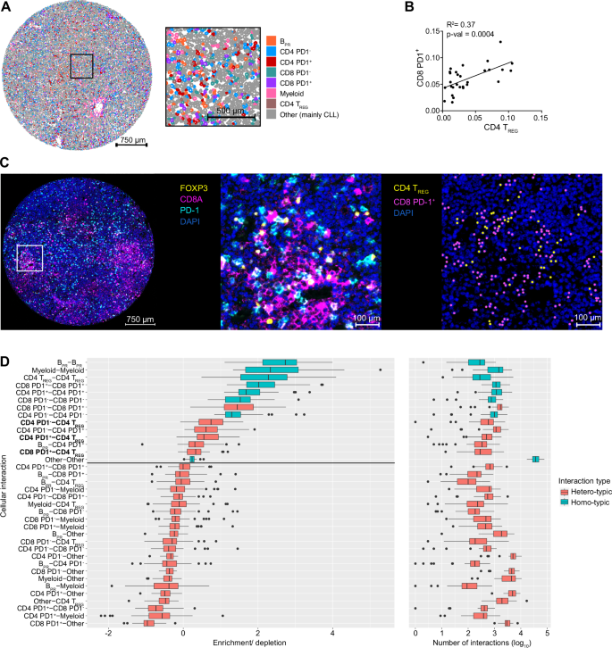 Waggoner Lab (@labwaggoner) on Twitter photo Galectin-9 is an immunotherapy target for modifying regulatory and exhausted T-cells in CLL
nature.com/articles/s4146β¦
<a href="/NatureComms/">Nature Communications</a> Galectin-9 is an immunotherapy target for modifying regulatory and exhausted T-cells in CLL
nature.com/articles/s4146β¦
<a href="/NatureComms/">Nature Communications</a>
