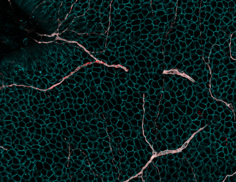 A new Science #Immunology study in mice suggests that TRPV1+ vagal #sensory neurons promote survival after #InfluenzaA infections by regulating proinflammatory cytokines and myeloid cell recruitment to the lungs. scim.ag/47aTRKt