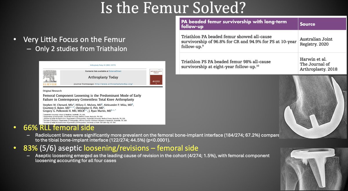 Christopher Pelt, MD (@peltmd) on Twitter photo In this study, the team adds to paucity of existing literature on the femoral side in cementless TKA. 66% of RLL were seen on the femoral side. 83% of the revisions for aseptic loosening were for the femur. <a href="/ArthroToday/">Arthroplasty Today</a> In this study, the team adds to paucity of existing literature on the femoral side in cementless TKA. 66% of RLL were seen on the femoral side. 83% of the revisions for aseptic loosening were for the femur. <a href="/ArthroToday/">Arthroplasty Today</a>