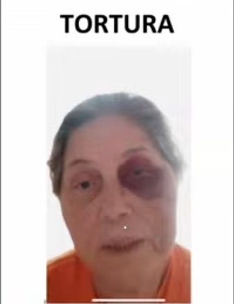 🚨URGENTE
Esta é Jucilene Costa, 62 anos, condenada pelo 8 de janeiro. Ontem à noite, ela foi agredida pela colega de cela. A agressora tinha descoberto o motivo da prisão de Jucilene, isto teria motivado o ataque.
LIBERTEM OS REFÉNS