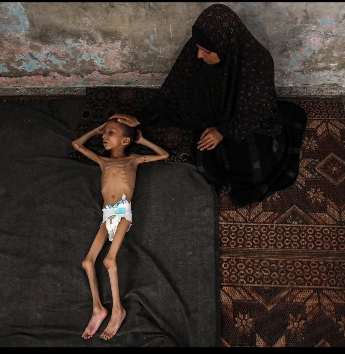 #GazzeAçlıktanÖlüyor