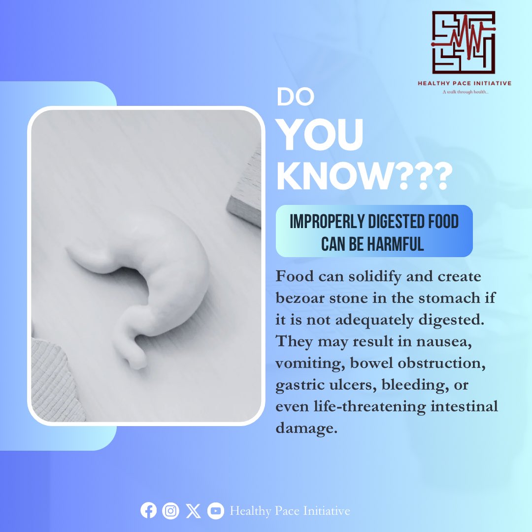 HealthyPace_'s tweet photo. 🗞🗞🗞
🍽️ Did you know? Undigested food can harden into a bezoar stone in your stomach 😱. 

Protect your gut—your health starts there! 💡 

We walk you through Health⛑️
#healthypaceinitiative #facts #fridayfact #guthealth #digestivehealth https://t.co/S8Mxk5ZREK