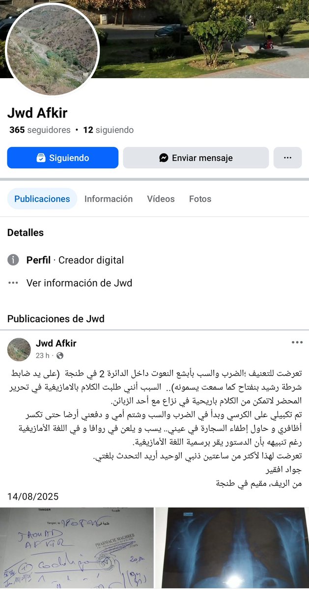 ما قام به هذا لاجئ العروبي ذنب لا يغتفر حنا في ارضنا نهدرو بلغتنا ما فهمتيش عاودها لكرك و لا سير لسعودية