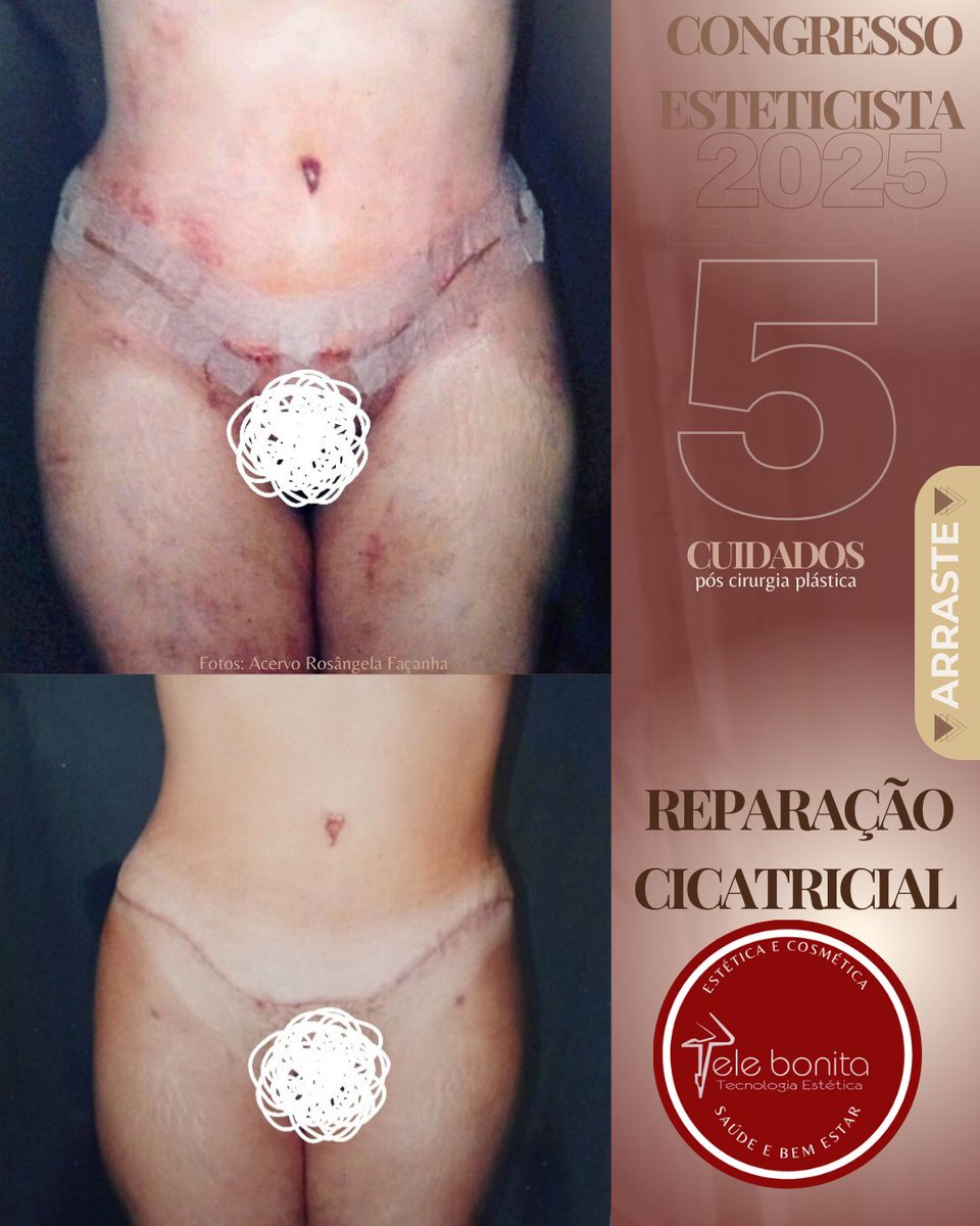 Leia tudo no link: instagram.com/p/DNqeGDeu1dI/…