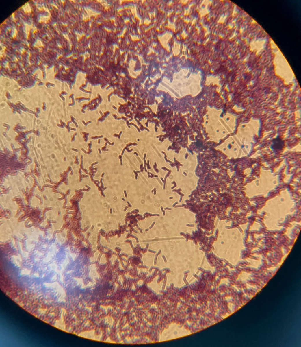 <a href="/drsghamdi/">د.صالح سالم الغامدي</a> مرحبا دكتور
كان لي تجربه مع طالبات بحث التخرج لعزل البكتريا النافعه من الكفير  في منتجي: 
أكتيفيا و Greek
كان العدد في كلاهما ممتاز و التنوع الميكروبي  في greek افضل حيث لاحظنا وجود Bifidobacterium بكميات ممتازه.