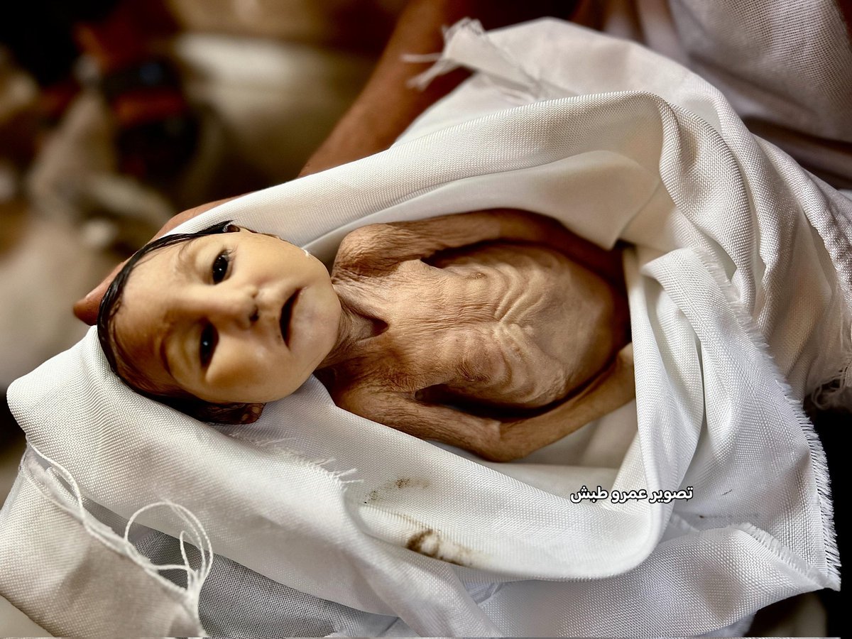 FZ_Ezz's tweet image. #Famine_in_Gaza #stopfamine
#IsraelPropaganda #IsraelLies
#Gaza_Genocide #IsraelisISIS