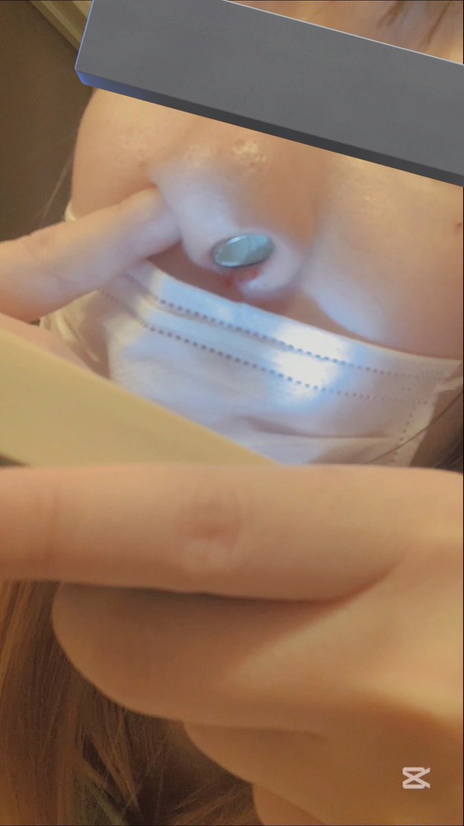 先日バタンキューしちゃって
お知らせポストできませんでしたが、

お鼻に無理やり入れられた鼻輪？ピアス？を頑張って取り出す動画
アップしました🌟

毎度「どーすんのこれ…😭」って心折れそうになります😇

ご覧の通り鼻の穴も悲鳴を上げて…🤫🩸

⬇️

adult.contents.fc2.com/article/474716…