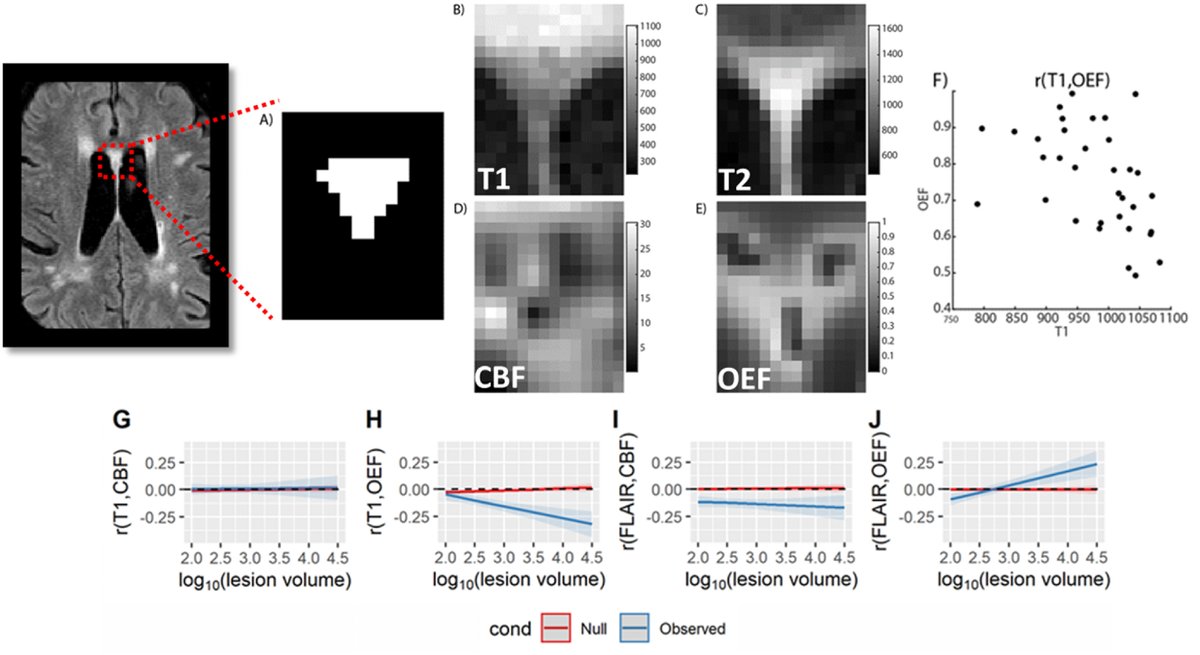 A new study from Peter Kang, MD, MSCI, found that subtle structural changes on conventional brain MRI sequences reflect underlying disease severity, ischemic vulnerability, and oxygen metabolic stress in cerebral small vessel disease.
bit.ly/4lqjDxL