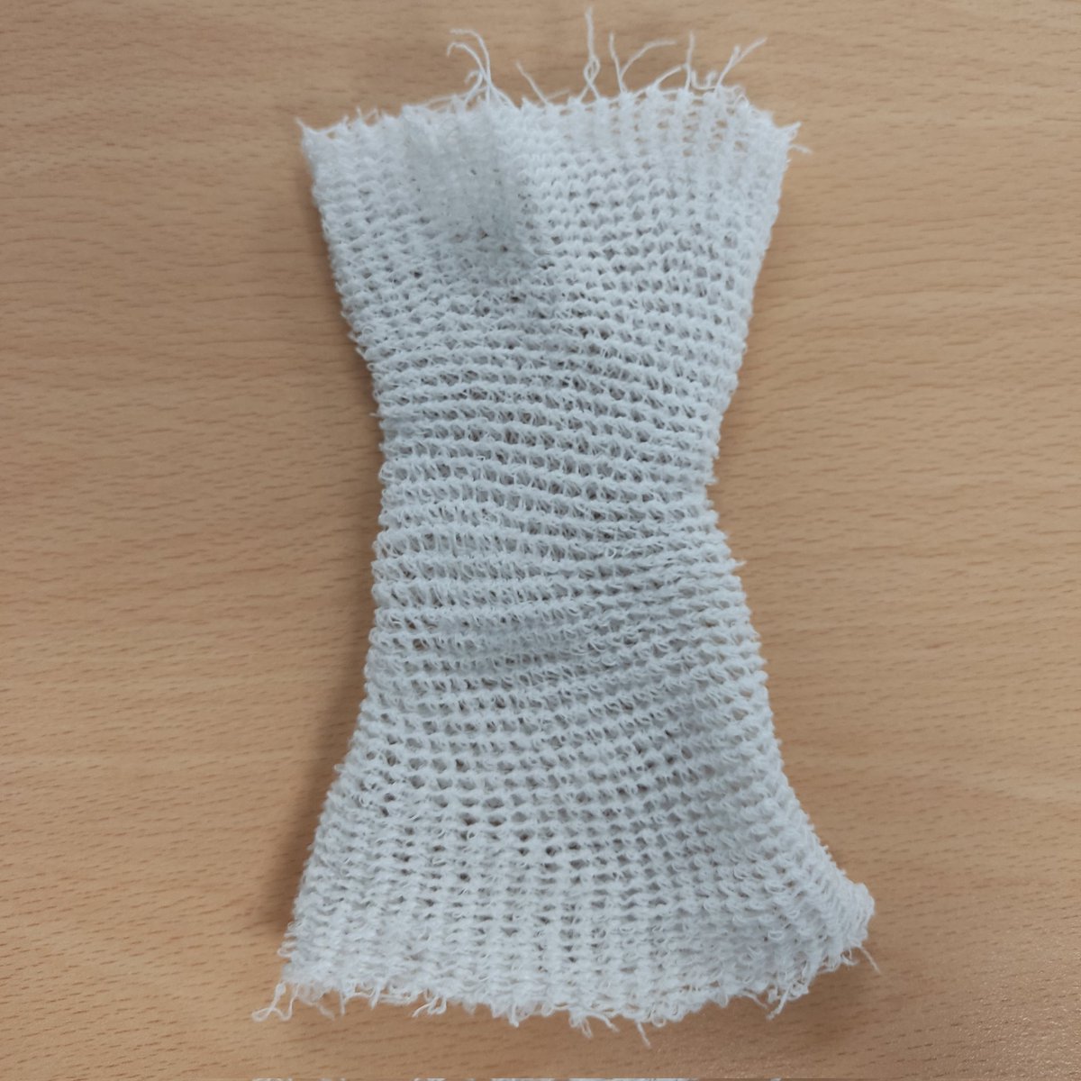 No tengo pruebas, pero tampoco dudas de que esta malla, que comprimía la misma Midline que pretendía proteger, ha favorecido la aparición de una trombosis del catéter.
❌ No a las vendas que compriman el brazo/catéter, mejor nada.
➡️ Repasen Triada de Virchow -> estasis venosa.