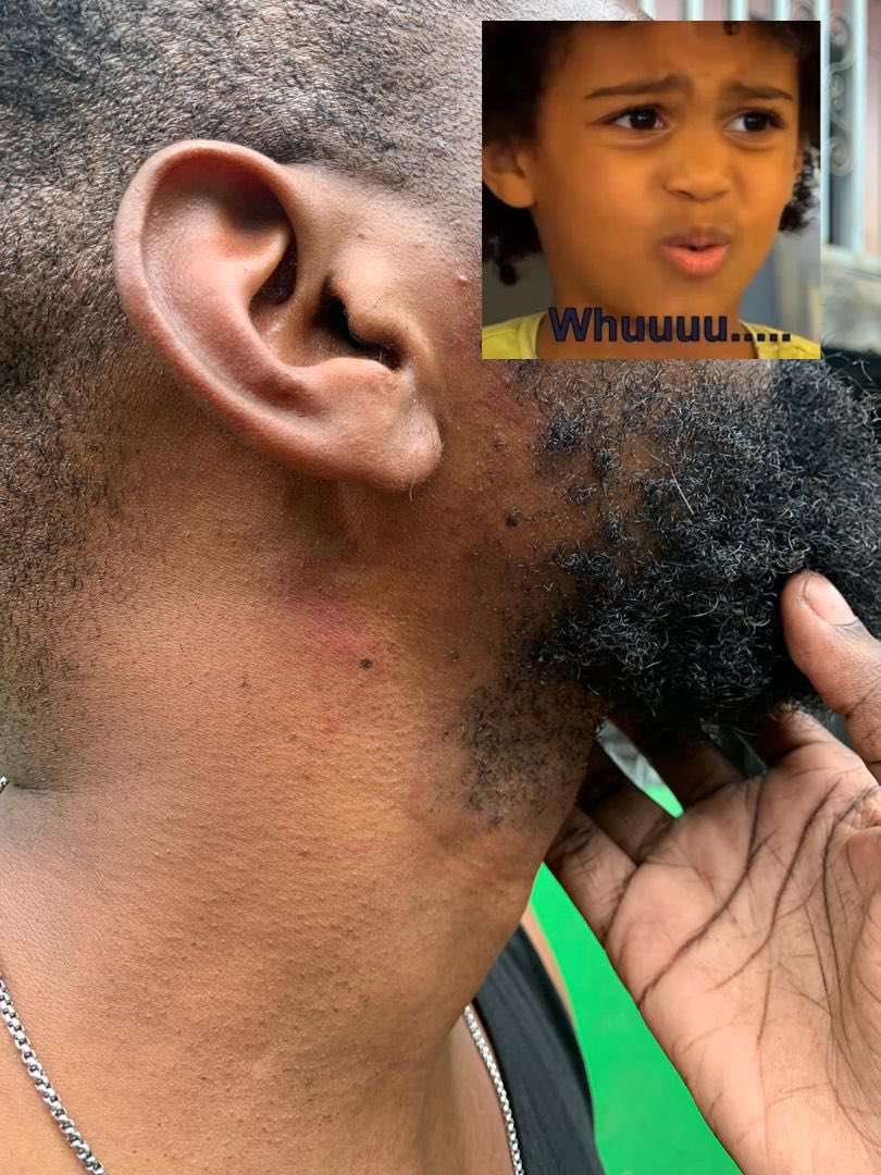 150 millions. Une vidéo. Un mensonge.
Résultat : Ayami Vauh torturé par la DGSS.
Sans preuve, sans enquête.
Dans un pays libéré, la violence reste leur seule vérité.
#Gabon