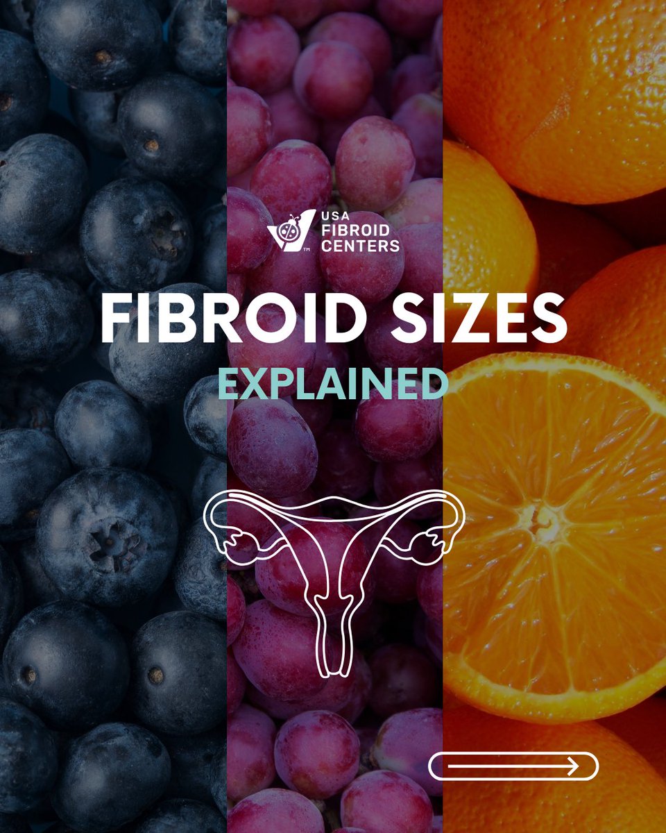 USAFibroid's tweet image. Size matters when it comes to your symptoms and treatment options. Don’t wait to find out what’s going on.

Schedule your appointment today!
📞 855-667-4247
🔗 ow.ly/fO7S50WIg3o
🩺 Most insurances accepted

#UterineFibroids #UFE #USAFibroidCenters