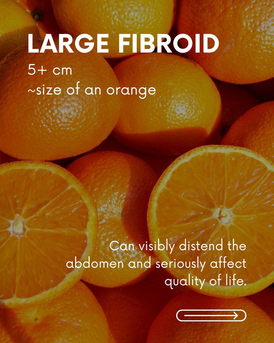 USAFibroid's tweet image. Size matters when it comes to your symptoms and treatment options. Don’t wait to find out what’s going on.

Schedule your appointment today!
📞 855-667-4247
🔗 ow.ly/fO7S50WIg3o
🩺 Most insurances accepted

#UterineFibroids #UFE #USAFibroidCenters