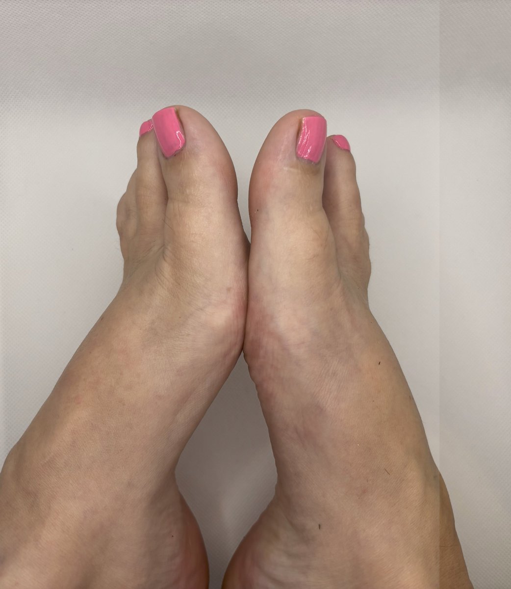 elegantinstep's tweet photo. Clean. Simple. Elegant. Every curve and line is on full display. This is just the beginning — see the full set in my bio."
#Feet #Toes #FootModel #SolesAndToes #ElegantFeet #CleanAesthetic #FootPhotography #MinimalVibes #FeetPic https://t.co/6tPejQyuuK