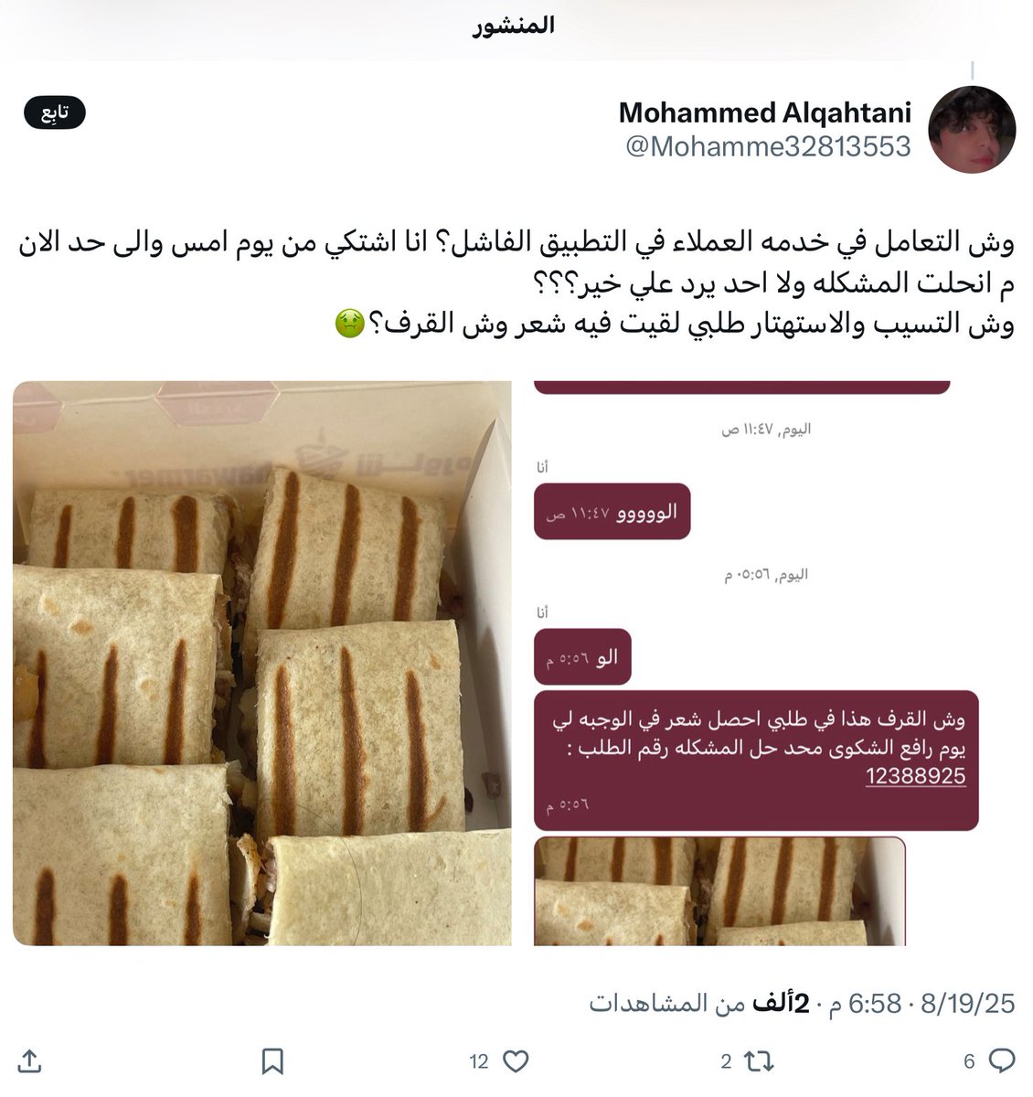 مواطن سعودي يشتكي من وجود شعر في وجبة شاورما من أحد المطاعم المشهورة بتوظيف المصريين وتمكينهم مما تسبب بانخفاض كبير في معايير النظافة في هذا المطعم
لم يعرف حتى الآن مصدر الشعر هل هو من إبط الموظف المصري أم من أنفه