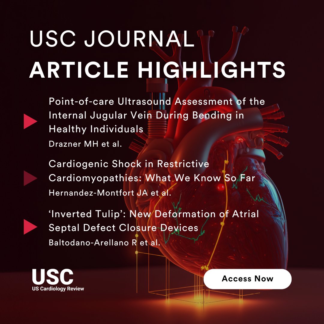 radcliffeCARDIO's tweet image. 📚Discover these featured articles in #USCJournal!✨

📄Point-of-care #Ultrasound Assessment of the Internal Jugular Vein During Bending in Healthy Individuals 👉 ow.ly/TQpA50WItN0

📄Cardiogenic Shock in Restrictive #Cardiomyopathies: What We Know So Far 👉