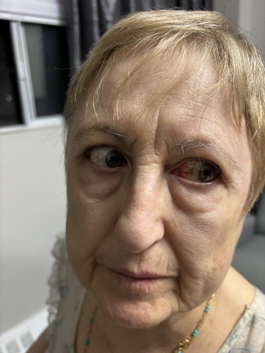 TonyYanko's tweet photo. I’ve been trying to stay patient but Ive had enough. How @amazonca treats their customers is unacceptable. I ordered a mattress delivered to my mom’s condo, left leaning on her door. When she opened it, it collapsed on her and injured her. Amazon has refused to help. @CP24 https://t.co/FgsgMMxexf
