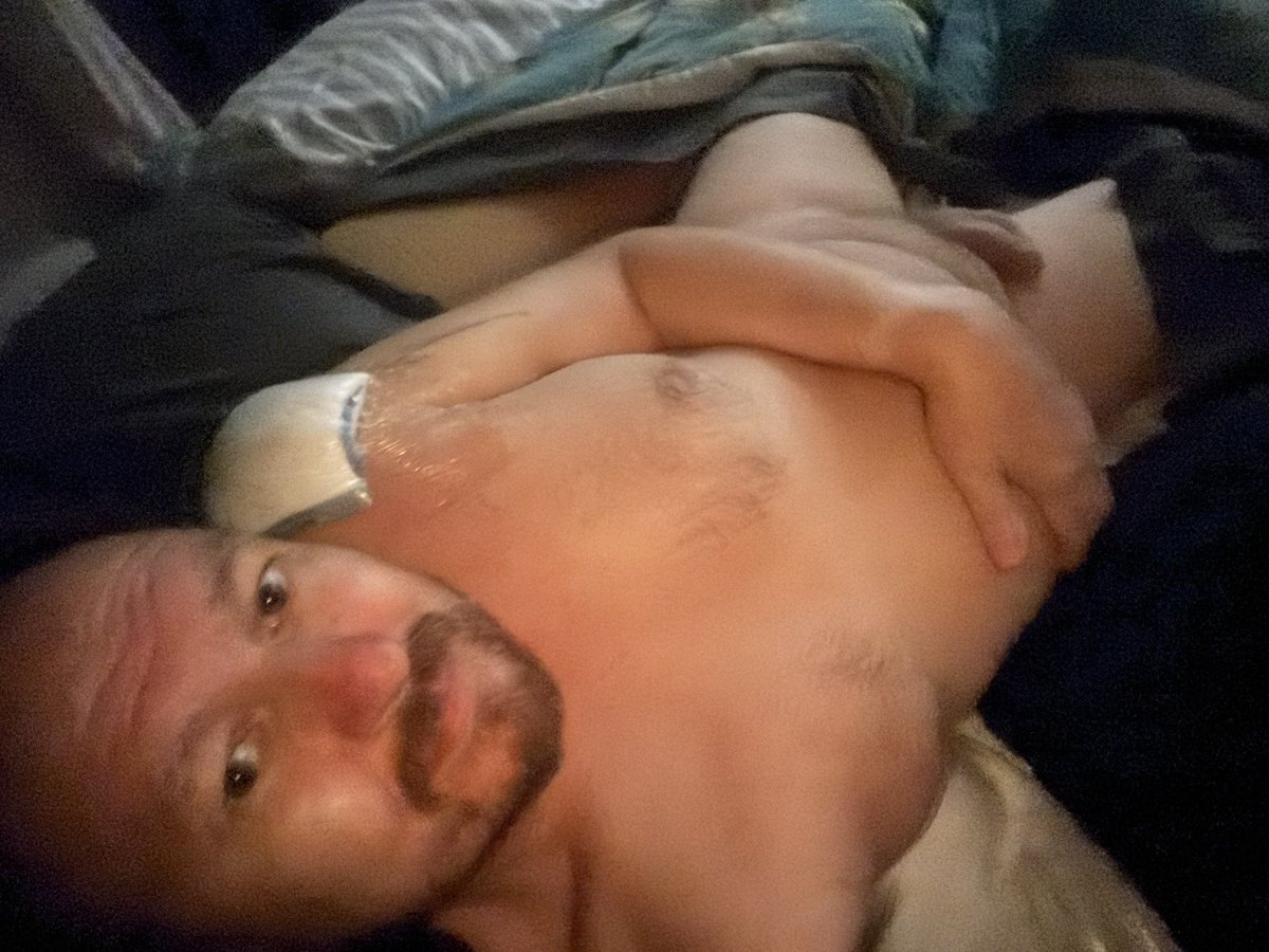 Had left shoulder surgery today. Arm still completely numb from anesthesia. Let’s hope I can sleep as I’m a side sleeper! #surgery #naked #nakedsleep #sleepinthebuff #sleepnaked #shouldersurgery