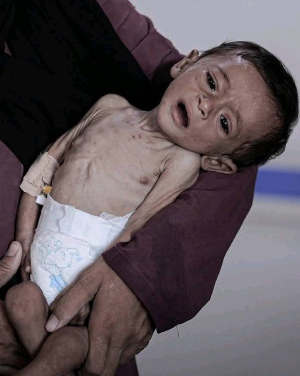 Stop the starvation in Gaza before time runs out 🇵🇸💔😢