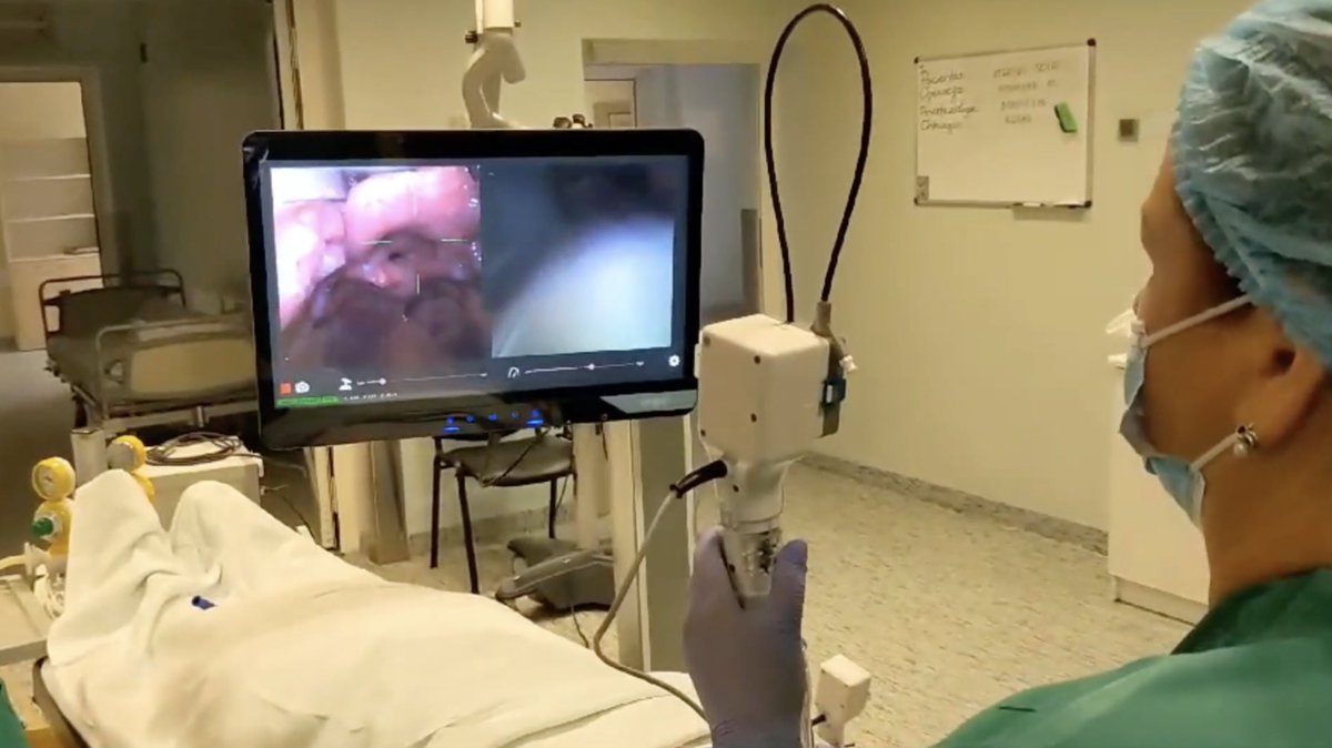 Stanford tested a new robotic system, Spiro-VISTA, for patients with difficult airways. In 30 high-risk cases, doctors succeeded on the first try every time — with no complications. bit.ly/41T78nw