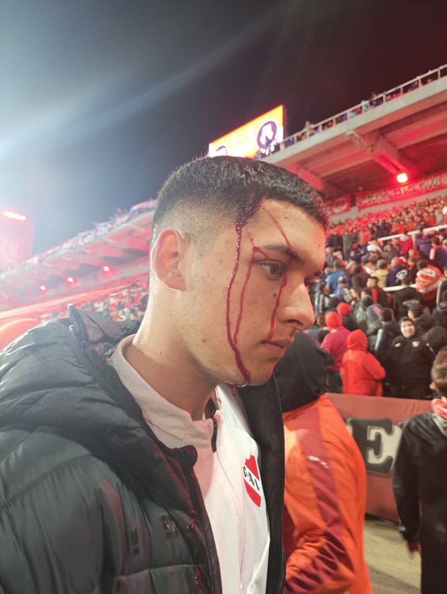 DieGOL1973's tweet photo. @agdws @CONMEBOL @Sudamericana   Respeten su reglamento.  Es inaceptable lo que sufrieron los hinchas de independiente con los inadaptados de la U de chile https://t.co/mf6OrU6ouA